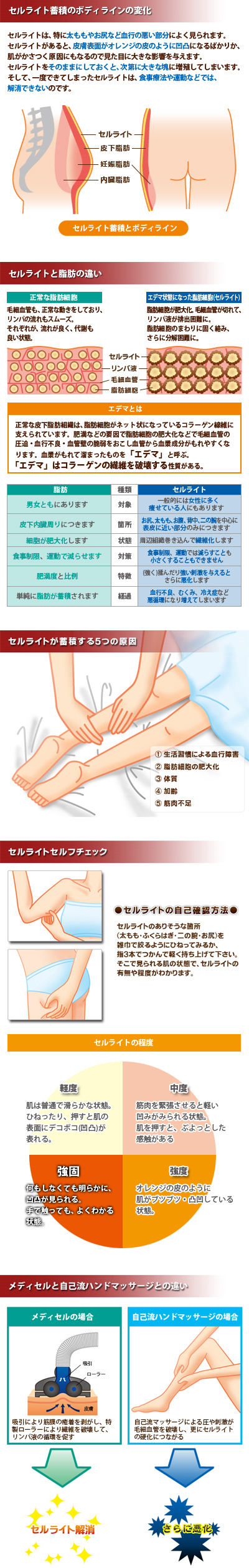 セルライトとは